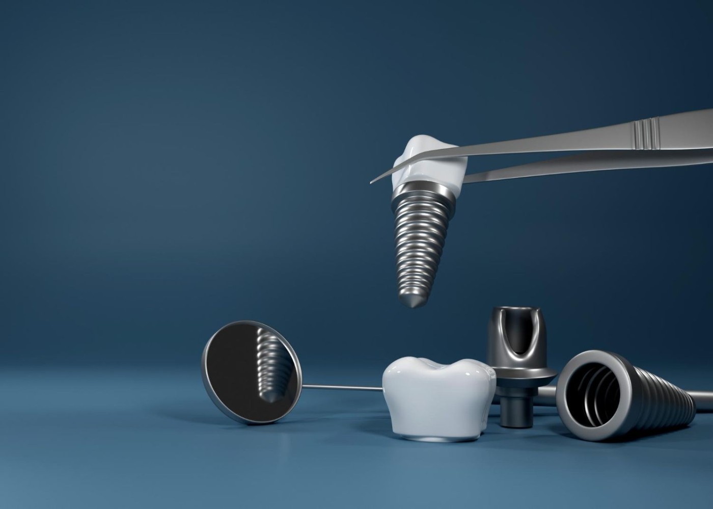 Ce tipuri de implanturi dentare se folosesc la Smile Avenue Nobel, Straumann sau alte sisteme